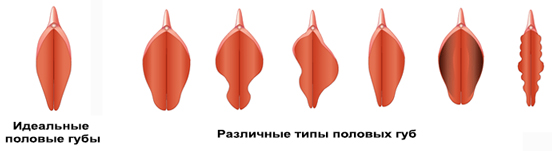 Причины для операции
